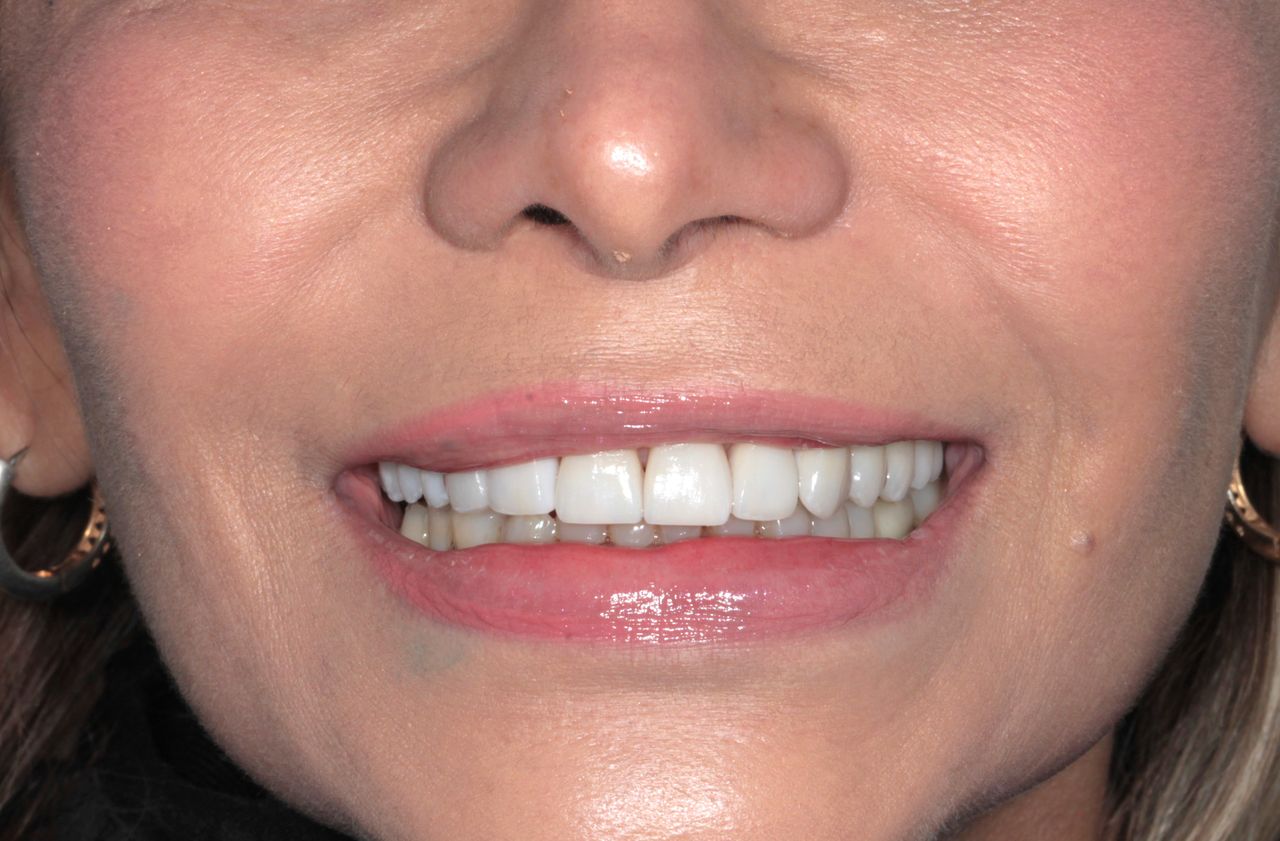 Mariel Itzayani Torres López-46