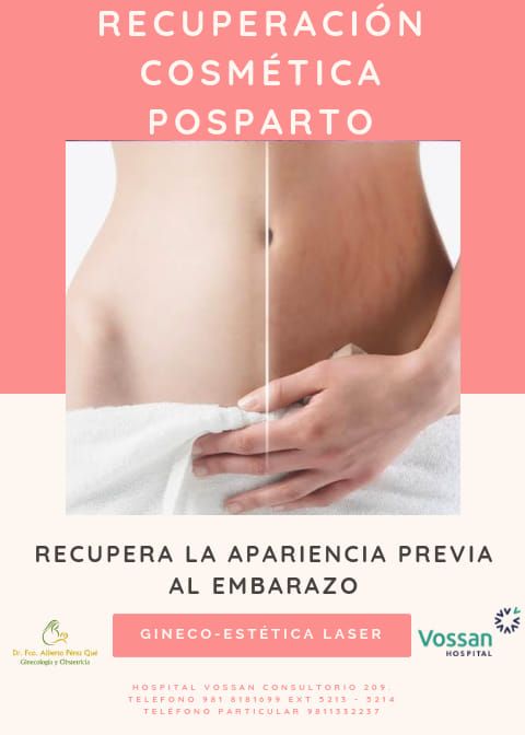 Francisco Alberto Perez Que-22