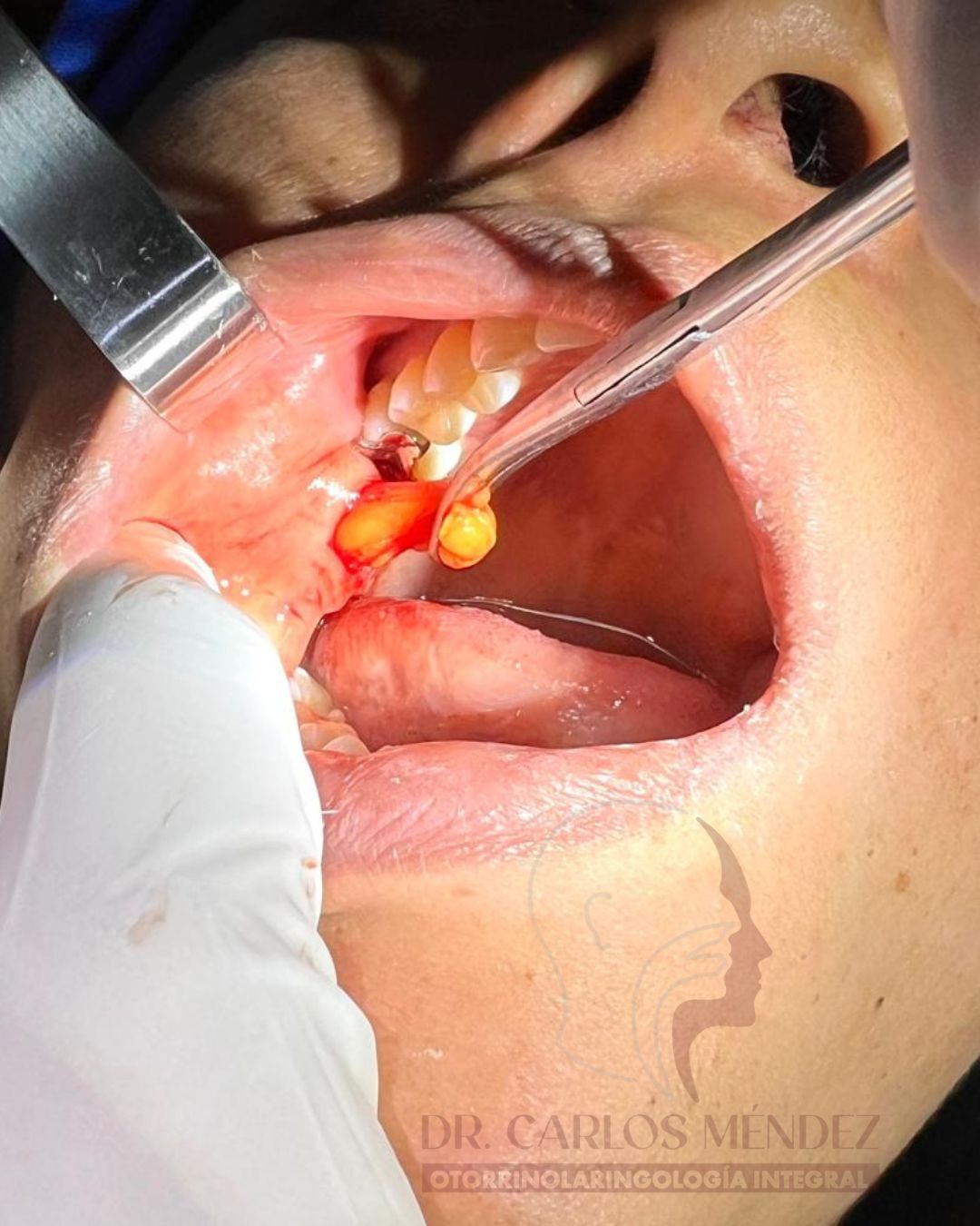 Juan Carlos Mendez Gutierrez-30