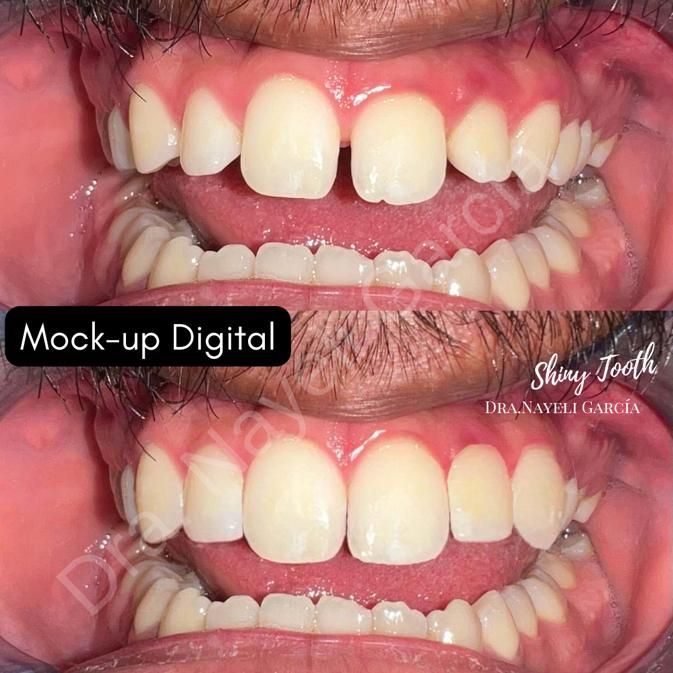 Nayeli Garcia Morales-28