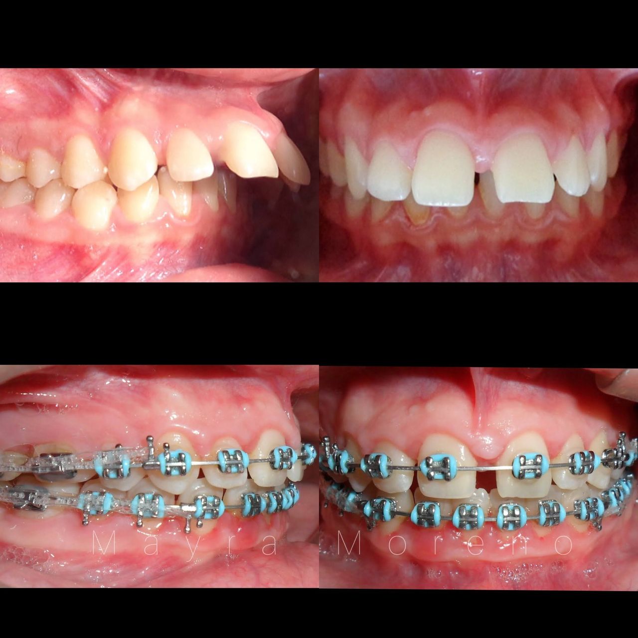 Mayra Moreno Rojas-9