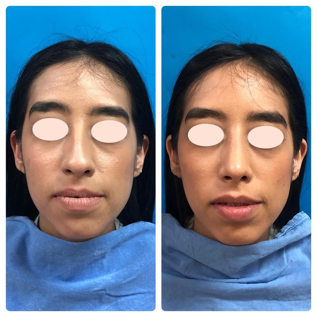 Carola Berenice Curiel Davalos-25