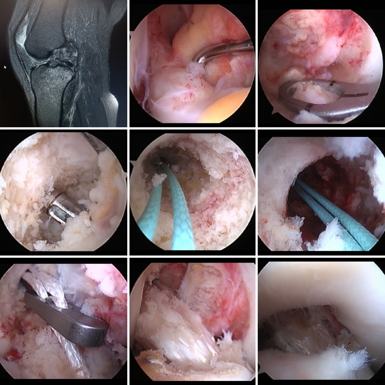 Jorge Manuel Valadez Soto-12