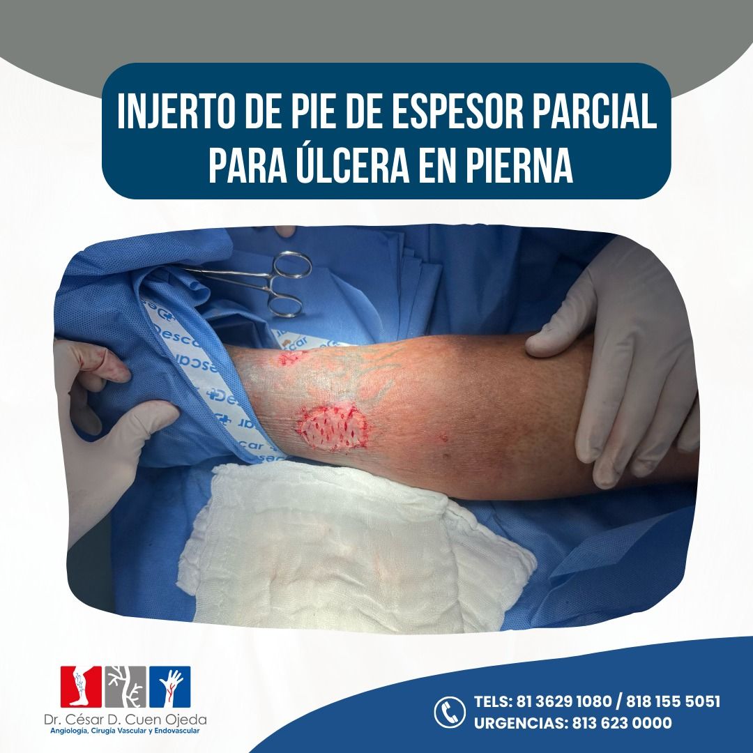 César Daniel Cuen Ojeda-12