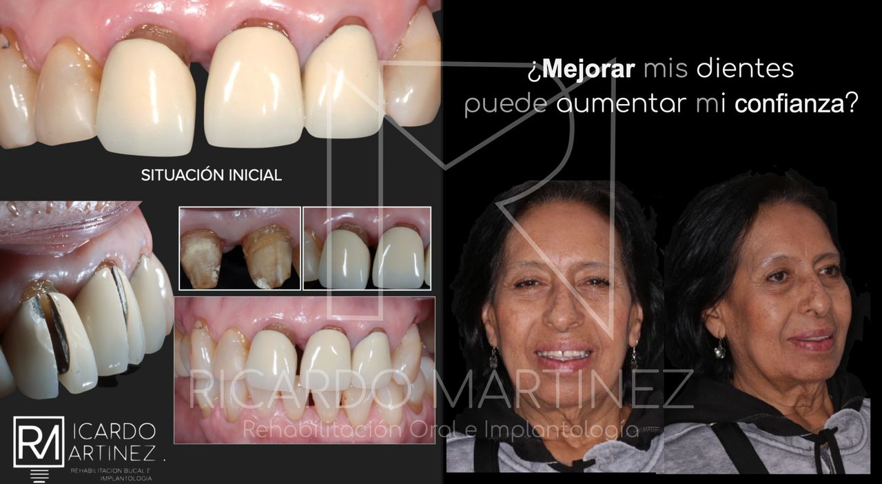 J. Ricardo Martínez-4