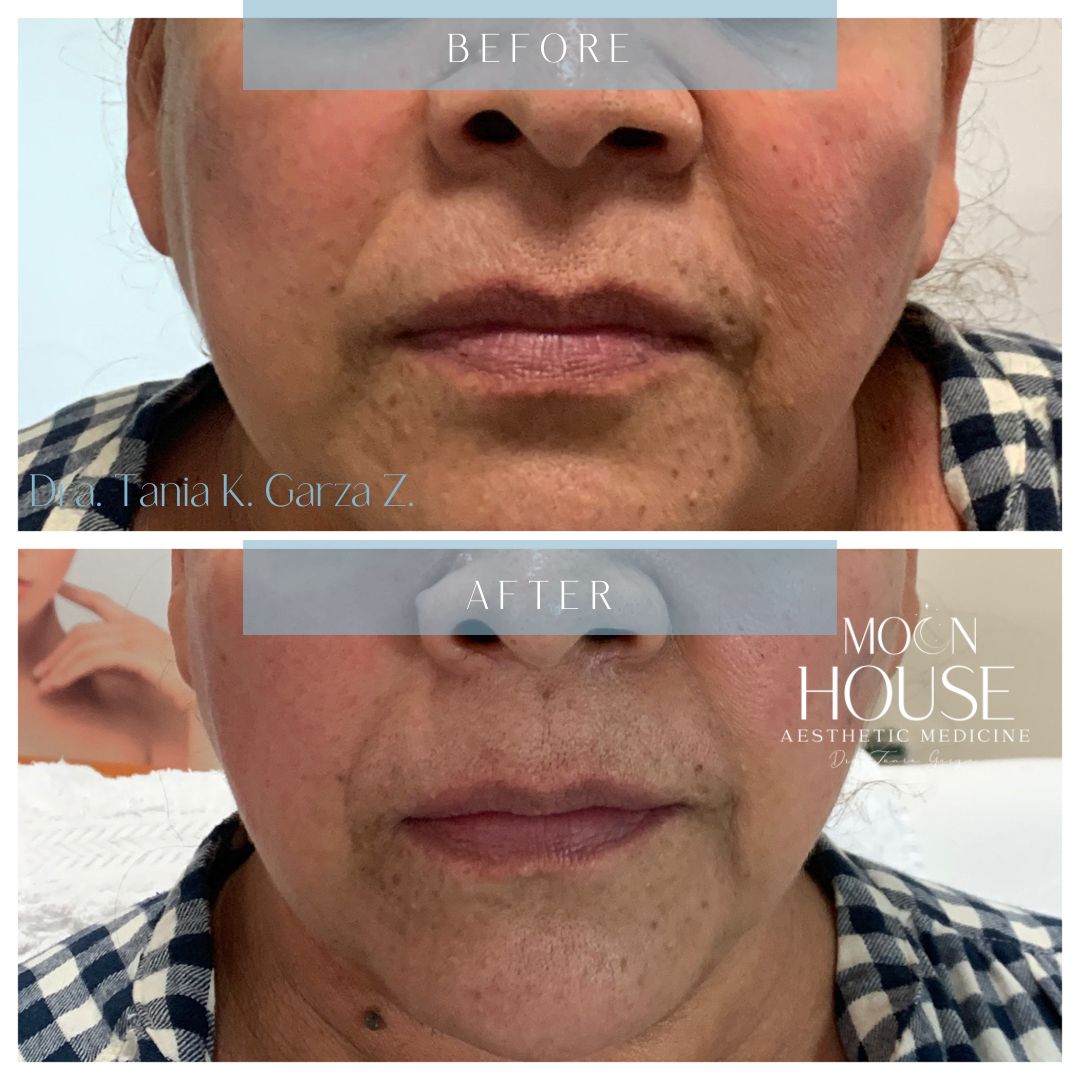 Tania Karine Garza Zepeda-10