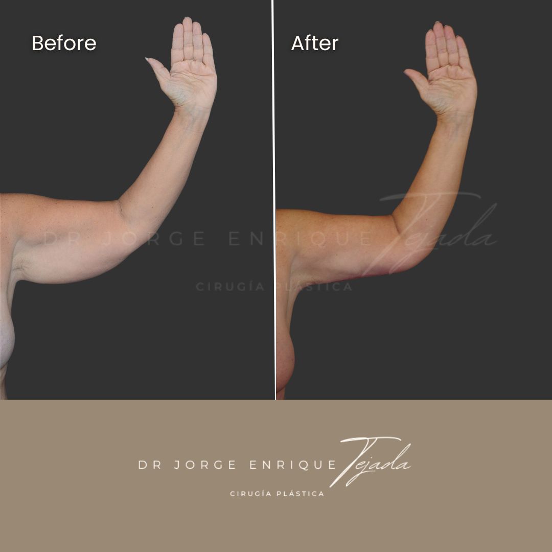 Jorge Enrique Tejada Aldazosa-9