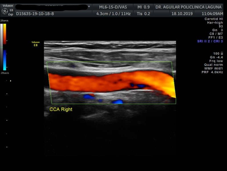 Edgar Fernando Aguilar Morales-18