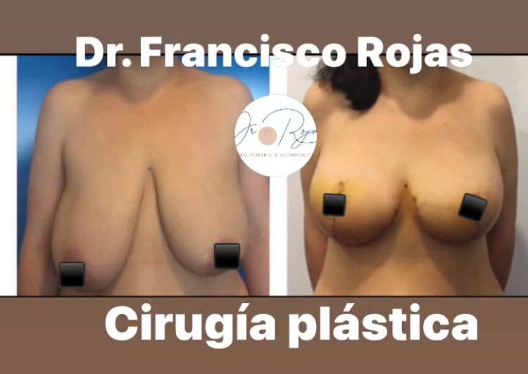 Francisco Rojas Aguilar-0