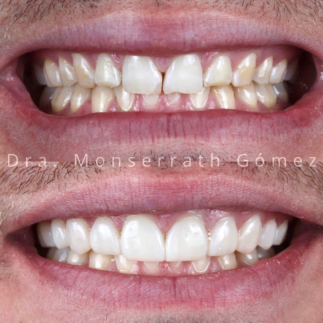 Monserrath Gomez Mendez-7