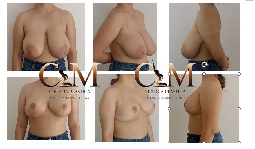 María Del Carmen Montilla Muñoz-5