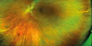 Hugo Francisco Valdez Flores-7