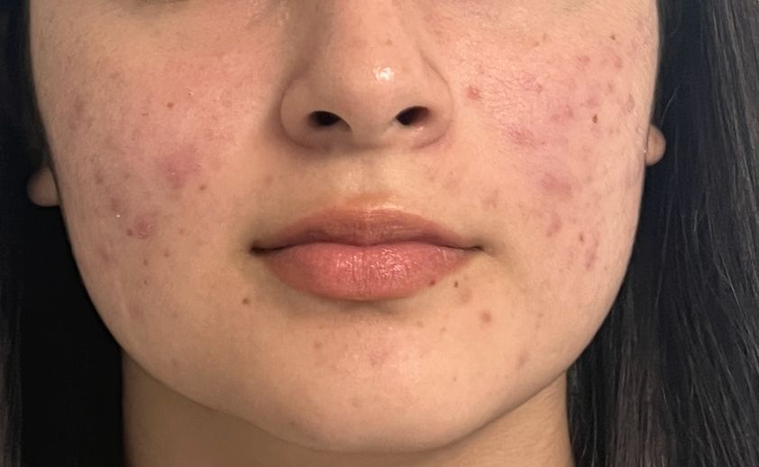 Lauro Francisco Varela Coronado-21