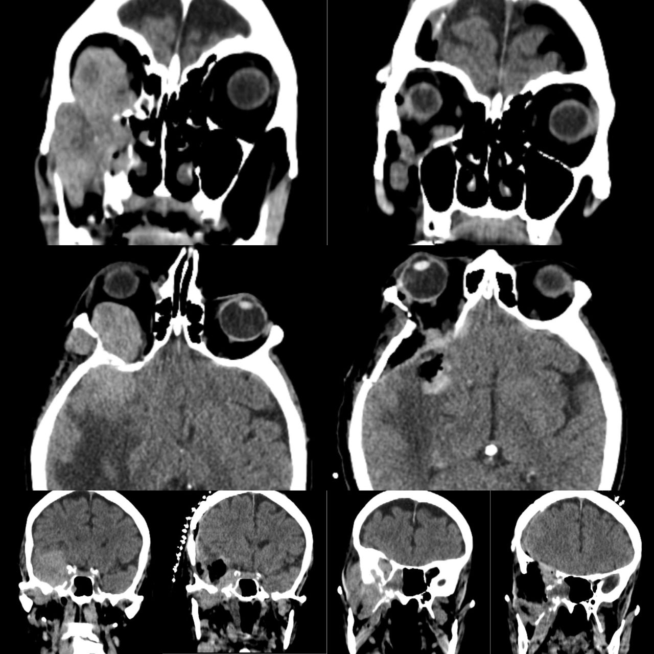 Celia Teresa De Jesús Álvarez Gamiño-18
