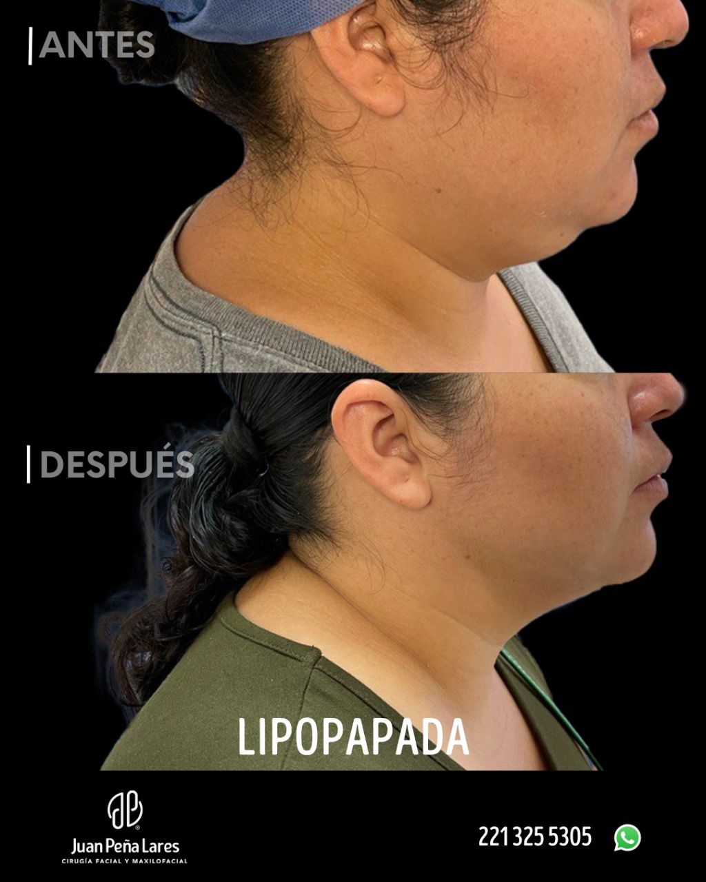 Juan Peña Lares-28
