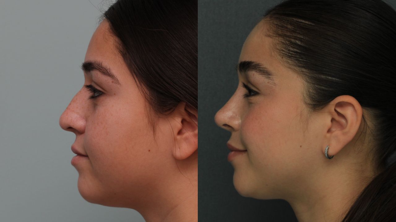 Angel Castro Urquizo-16