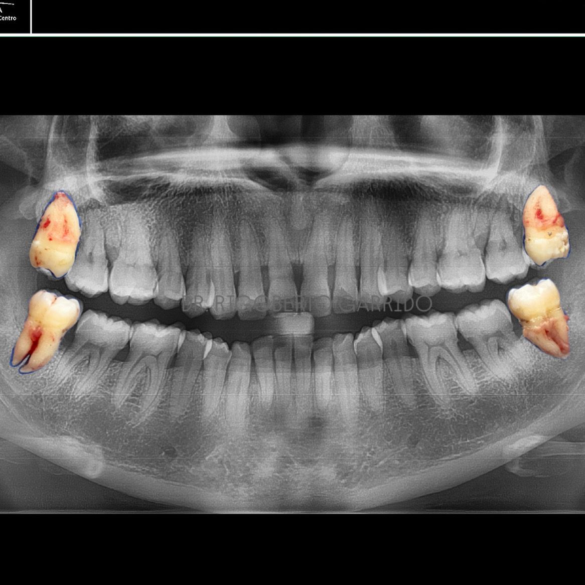 Rigoberto Garrido Dionisio-1