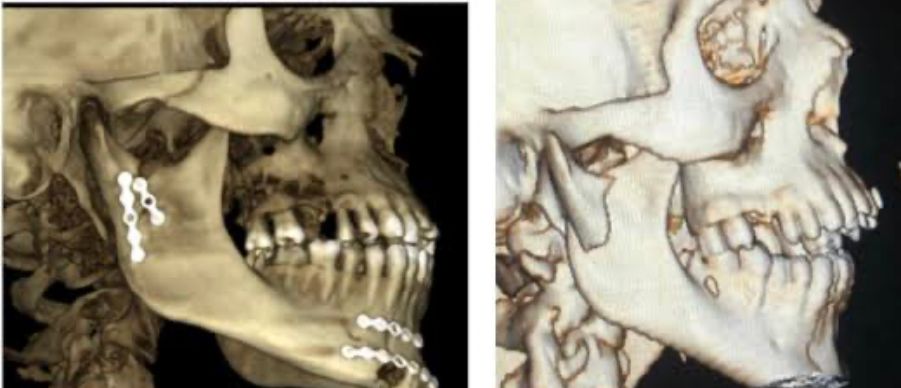 Erendalhi Rocha Mesta-11