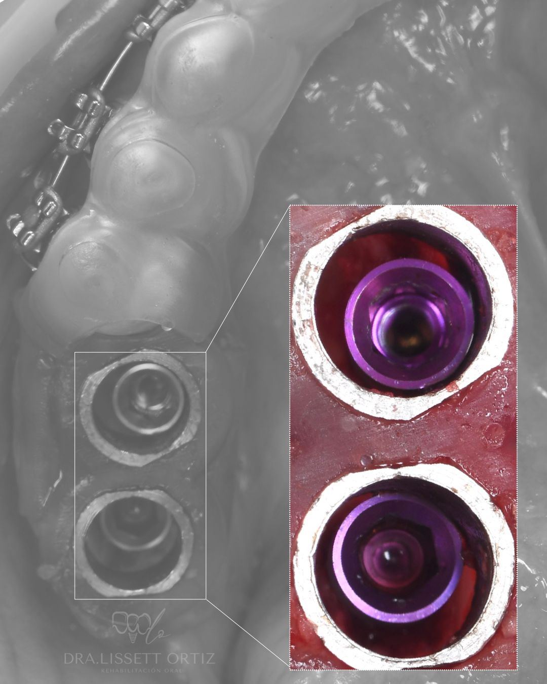 Ana Lissett Ortiz-34