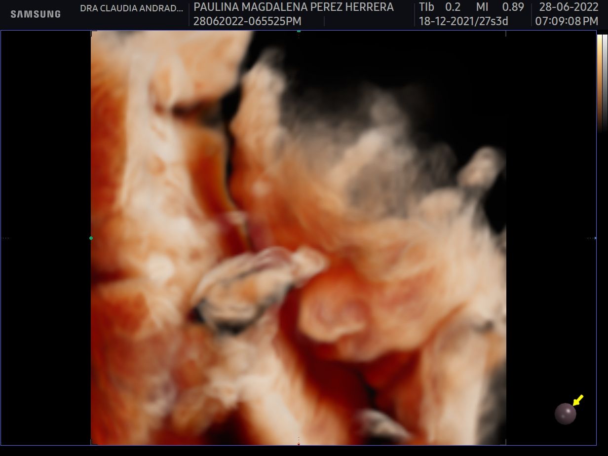 Claudia Andrade Ruano-1