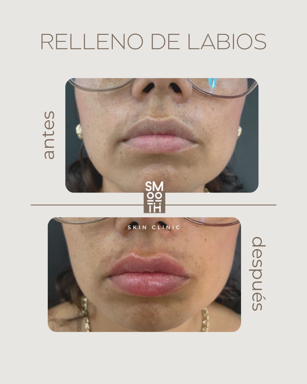 Samantha Martínez-83