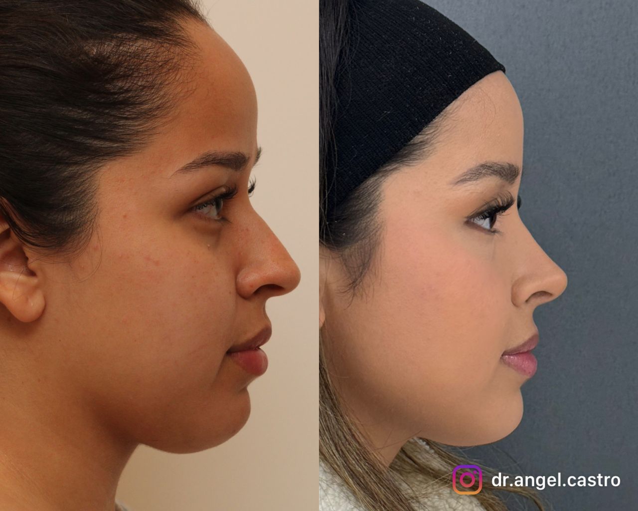 Angel Castro Urquizo-76