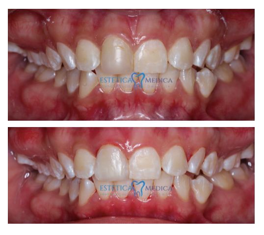 Bielmy Veronica Jonapa Peña-3