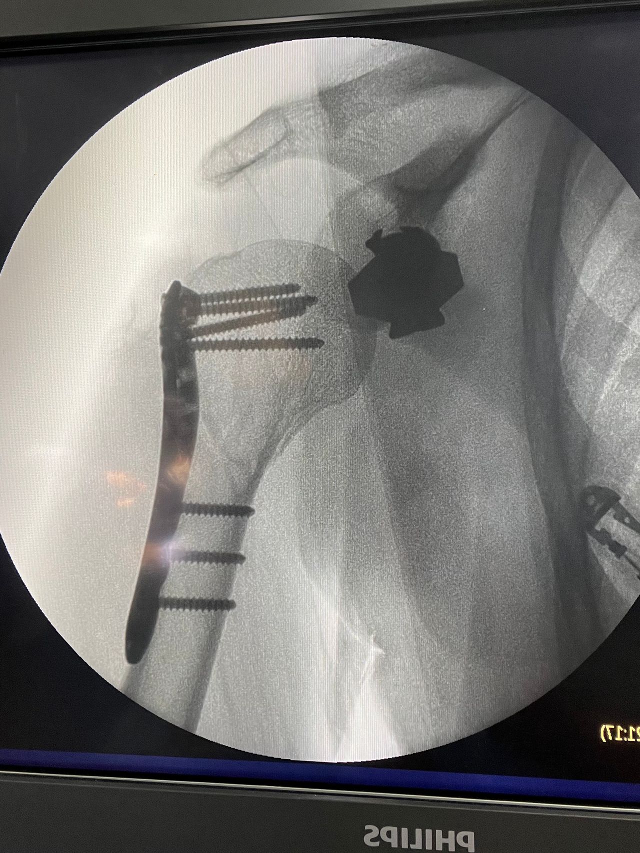 Cristian Ernesto Murillo Medina-23