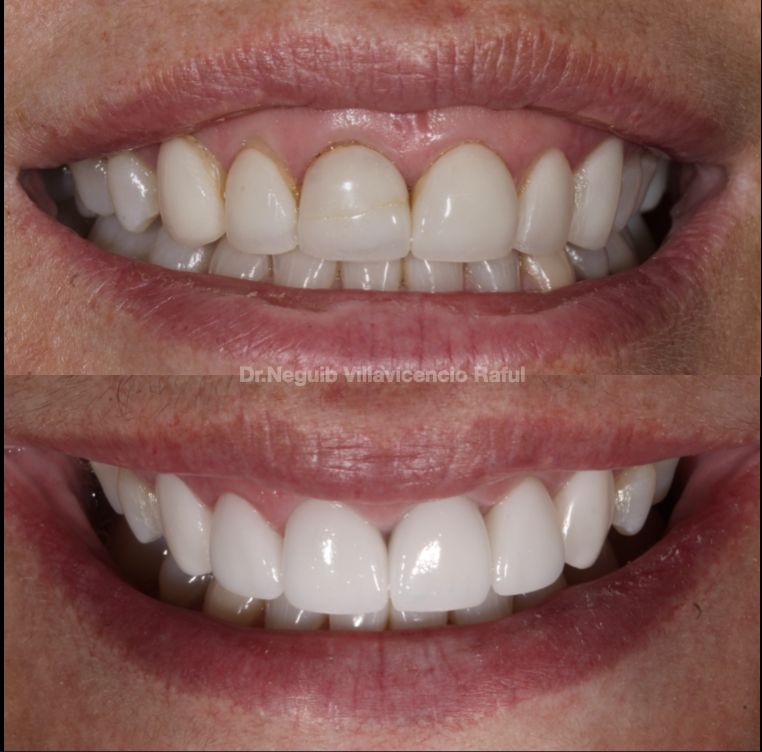 Neguib Villavicencio Raful-35