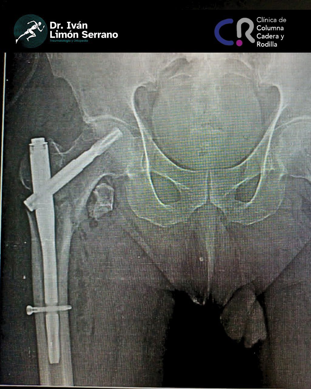 Iván Limón Serrano-42