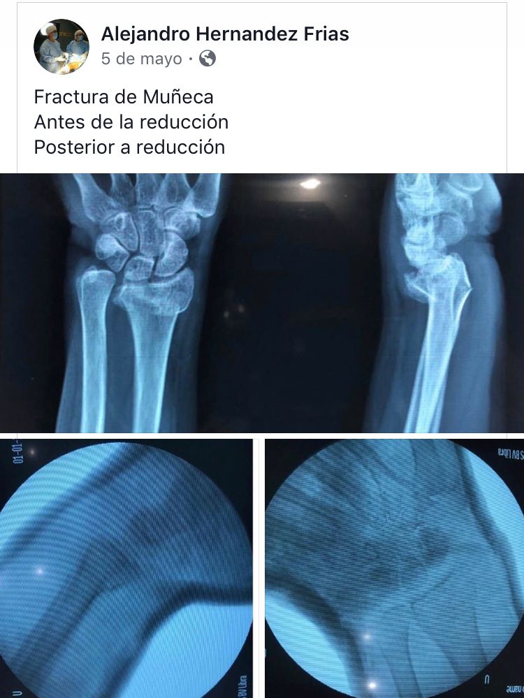 Alejandro Hernandez Frias-12