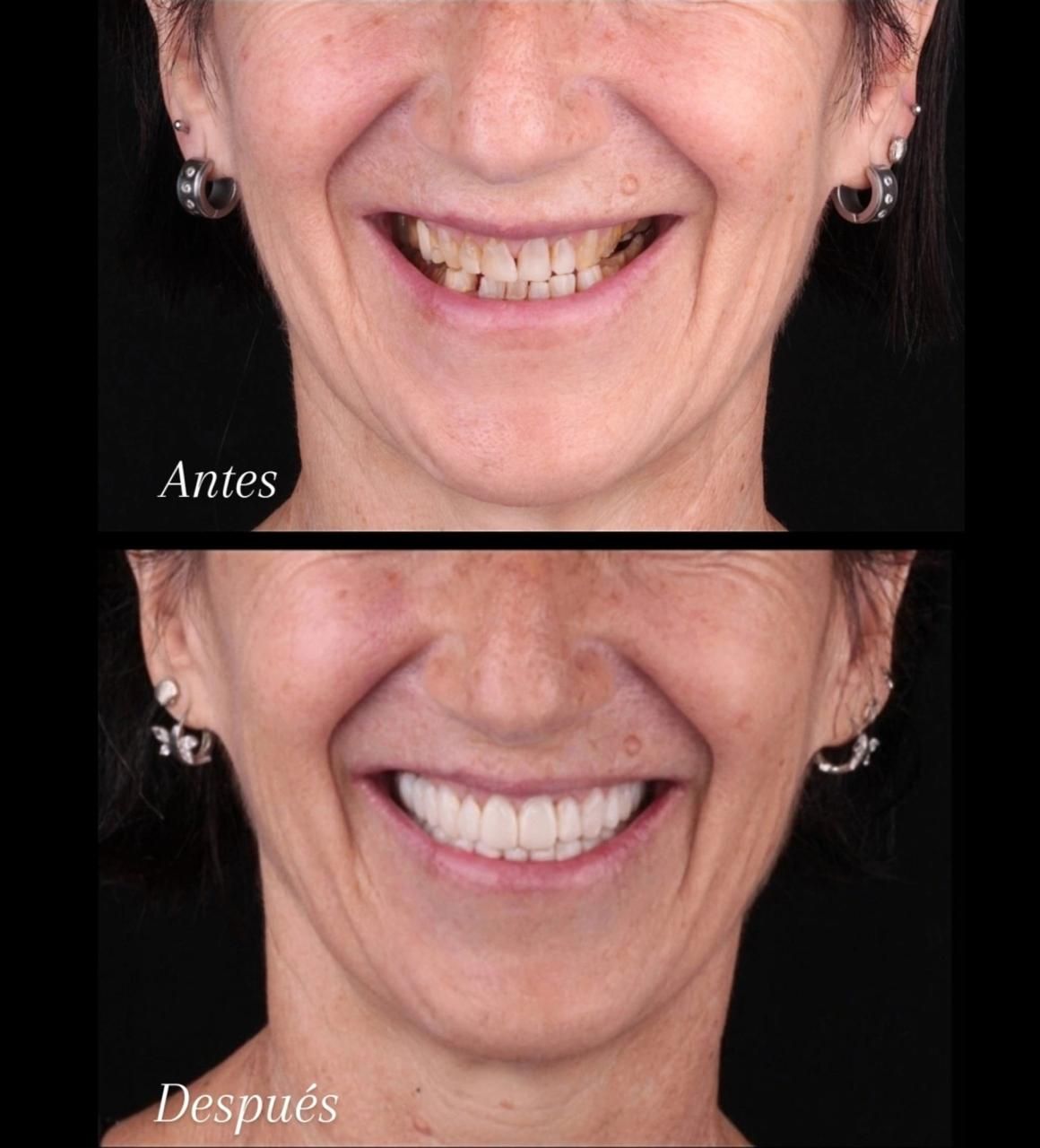 Diana Chacon Cervera-2