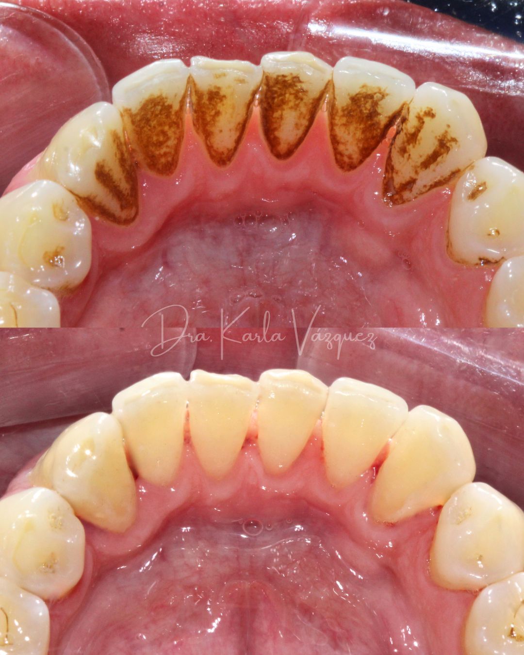 Karla Denisse Vázquez Olmedo-7