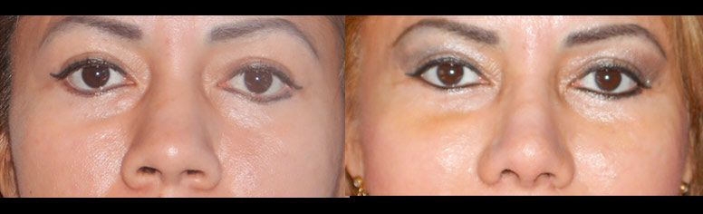 Edgar Ernesto Torres Mejía-22