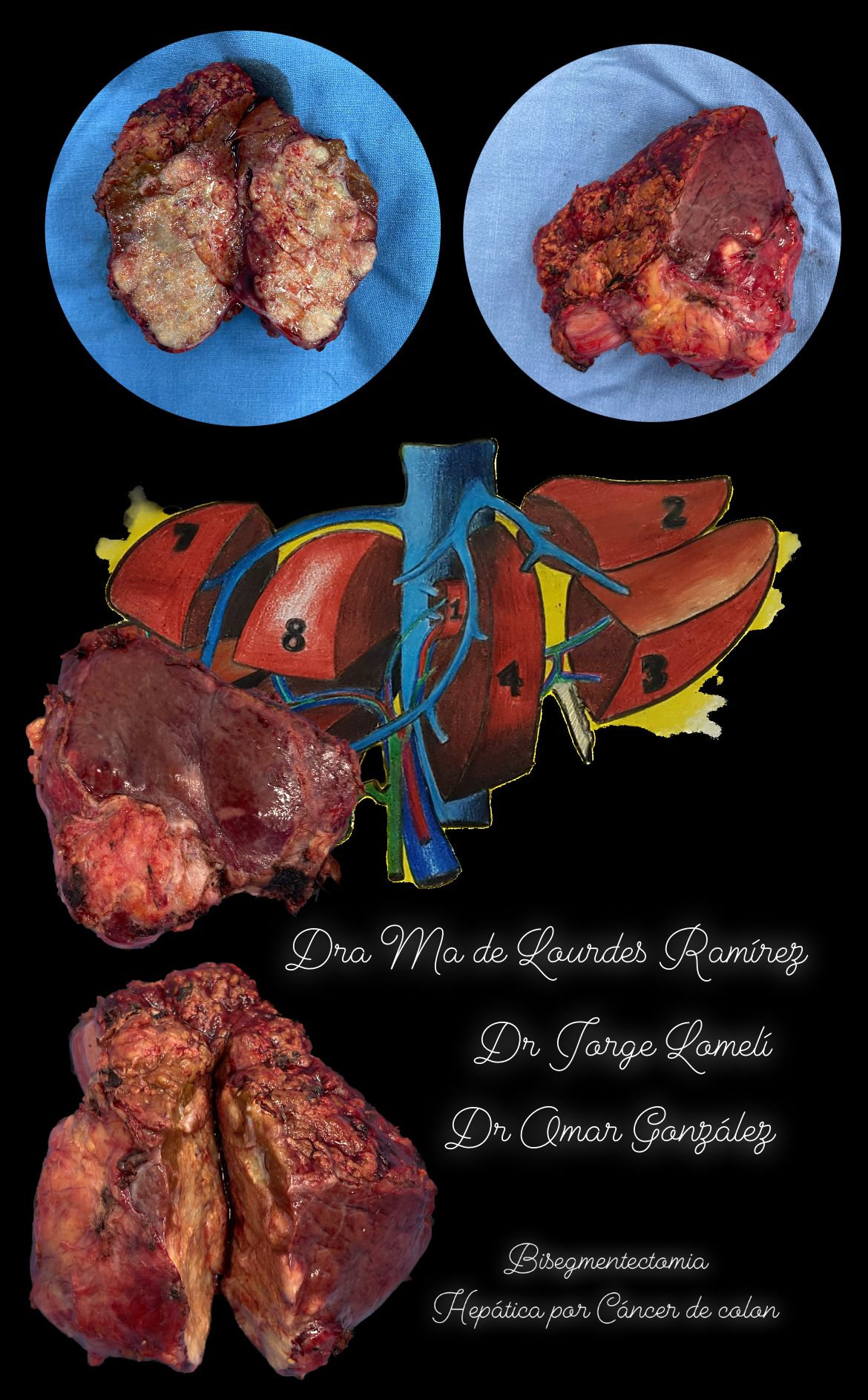 Jorge Antonio Lomeli Muñoz-60
