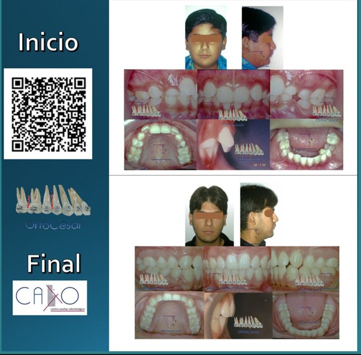 César Augusto Pérez Córdova-10