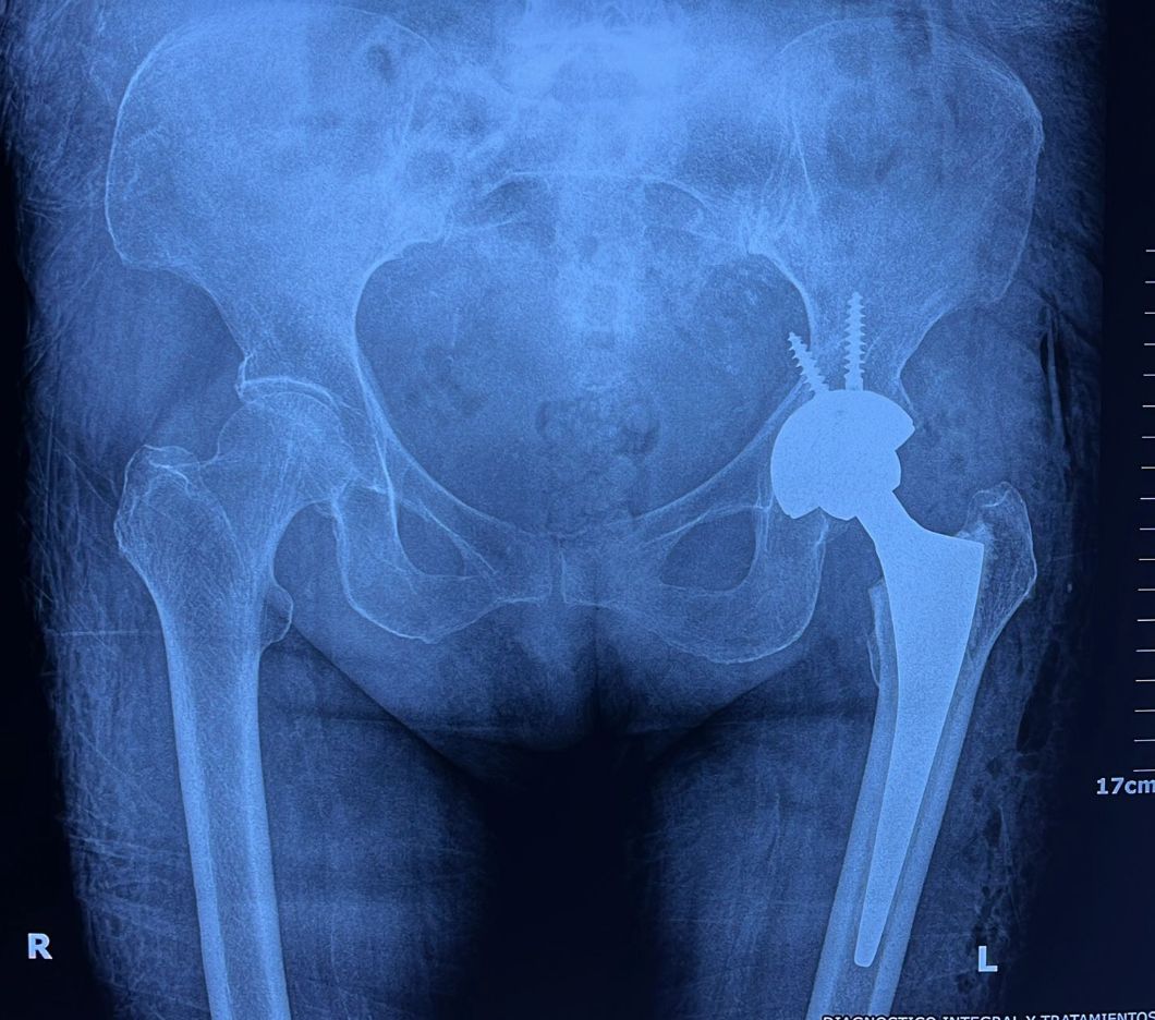 Cristian Ernesto Murillo Medina-32