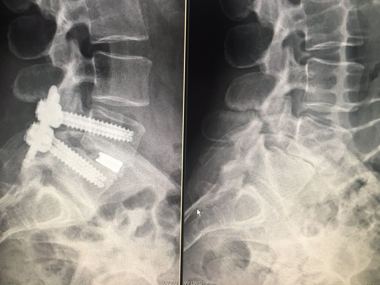 Simón Almanza Mendoza-1