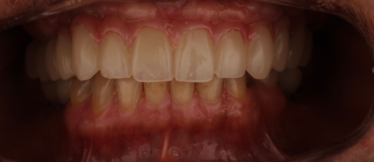 Lilly Bentriz Sifuentes-2