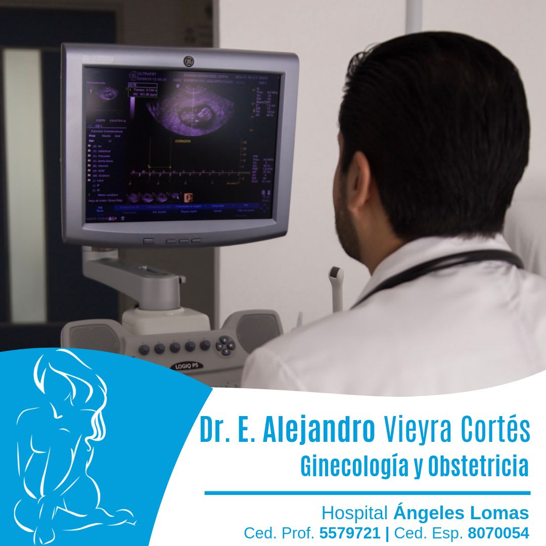 Edmundo Alejandro Vieyra Cortes-11