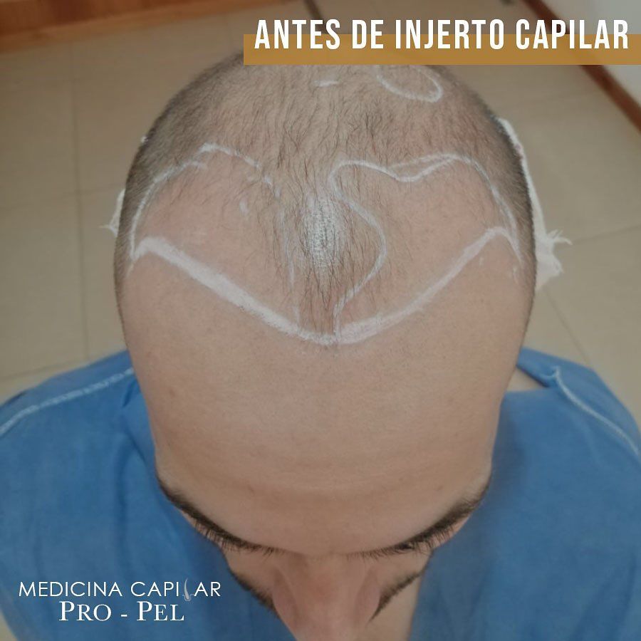 Karla Vanessa Becerra-45