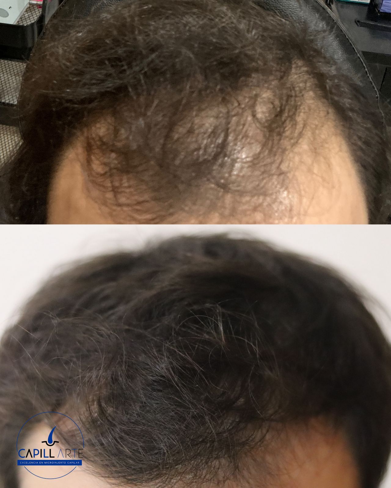 Adrian Hernandez Lopez-11