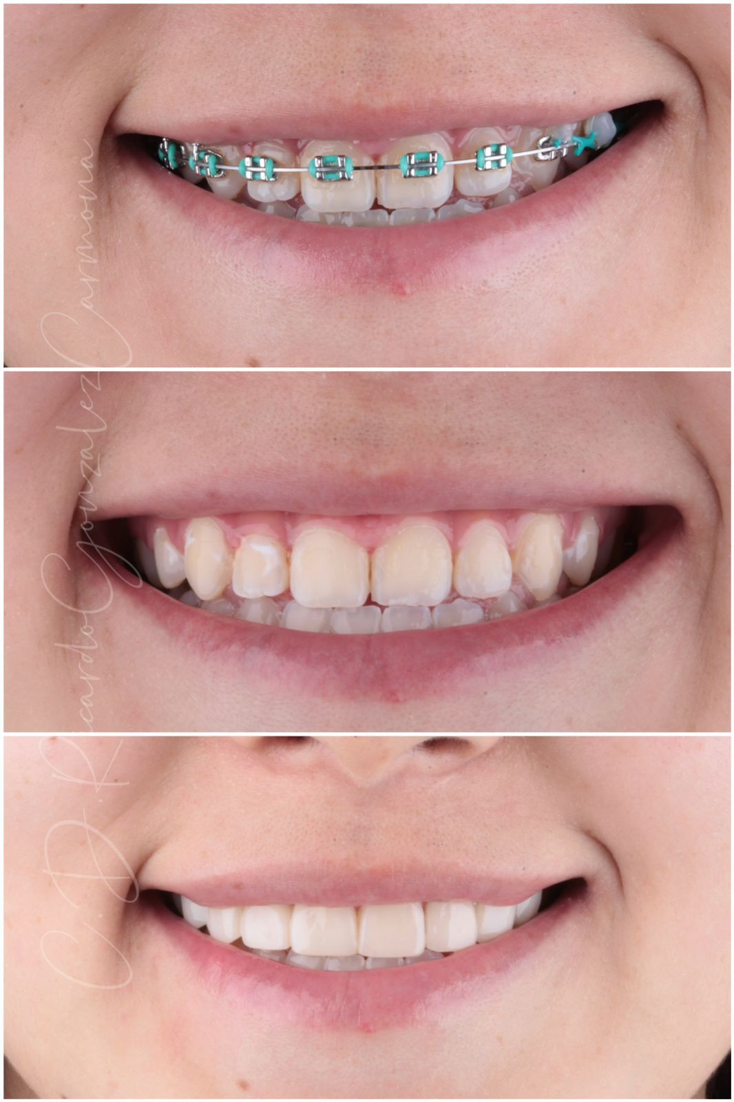 Alicia Carmona López-14