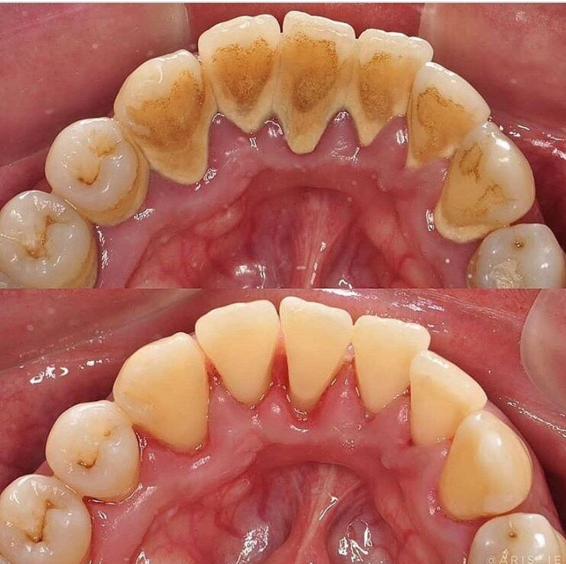 Alejandro Angelo López Díaz-8