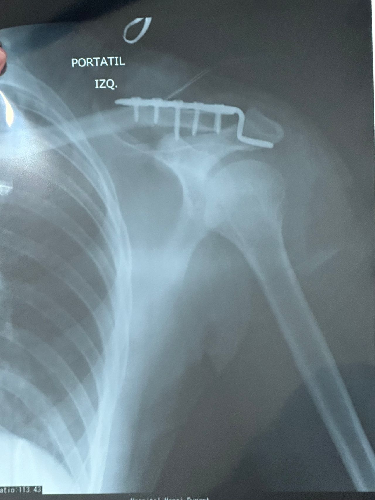 José Miguel Montiel Rojas-14