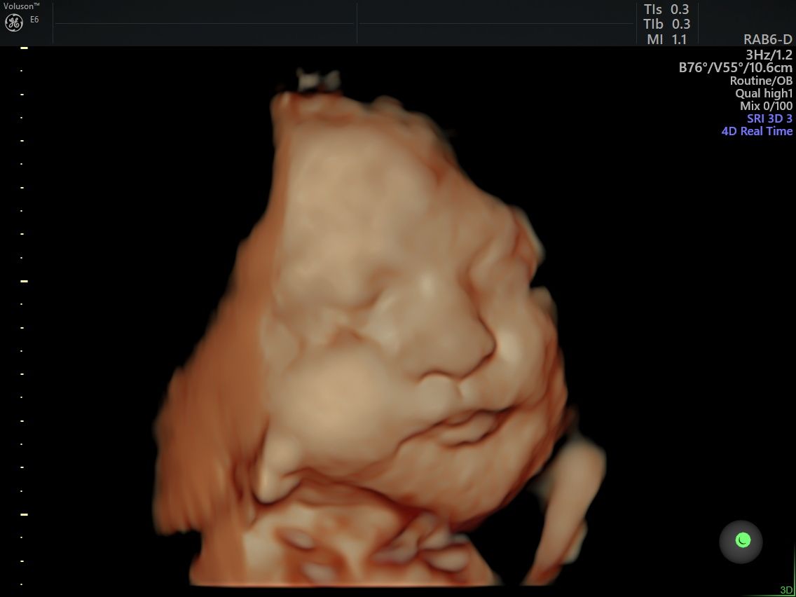 Edgardo Reyes Ponce-5