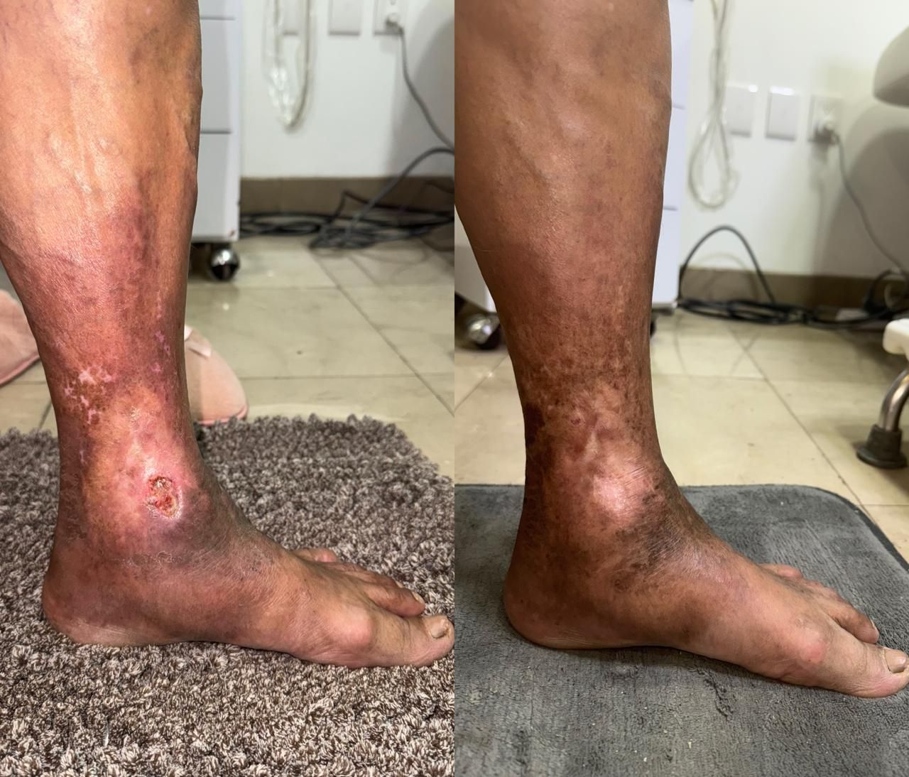 Jhonatan López González-71