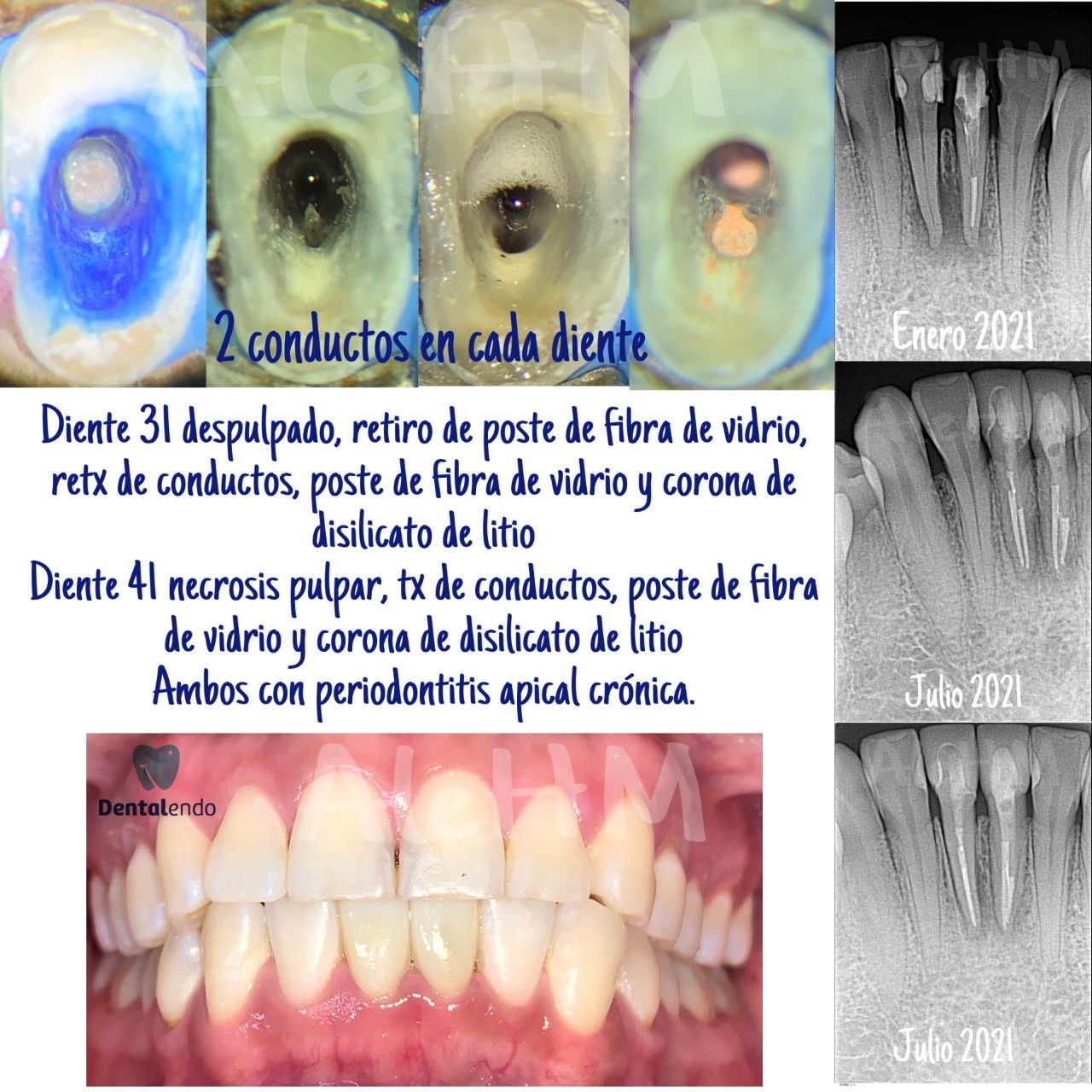 Alejandra Heredia Morán-16