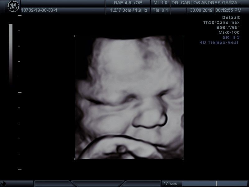 Carlos Andrés Garza Flores-0