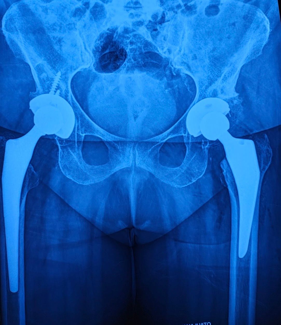 Josué Jonatan Arcia Guzmán-15